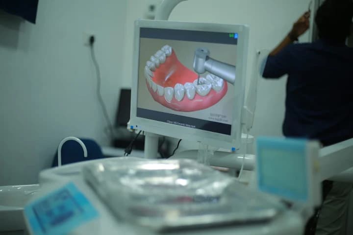 Equipment